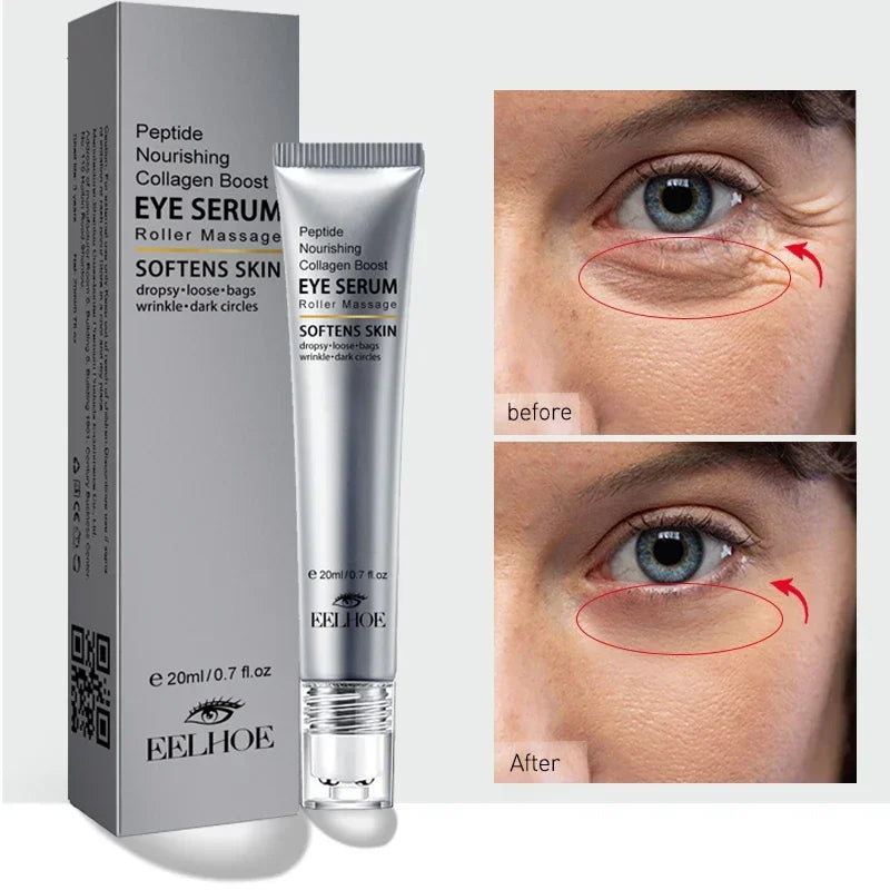 Peptide Eye Bags Eye Cream anti Dark Circle Hyaluronic Acid Wrinkle Removal Cream Roller Massager Skin Care Beauty