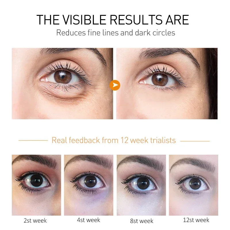 Peptide Eye Bags Eye Cream anti Dark Circle Hyaluronic Acid Wrinkle Removal Cream Roller Massager Skin Care Beauty