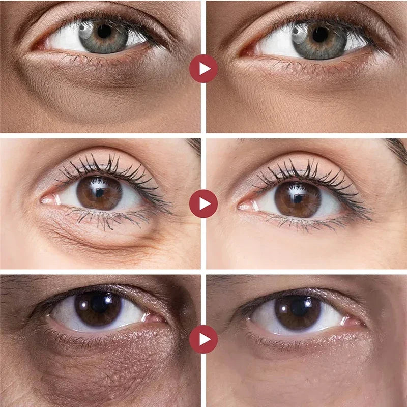 Peptide Eye Bags Eye Cream anti Dark Circle Hyaluronic Acid Wrinkle Removal Cream Roller Massager Skin Care Beauty